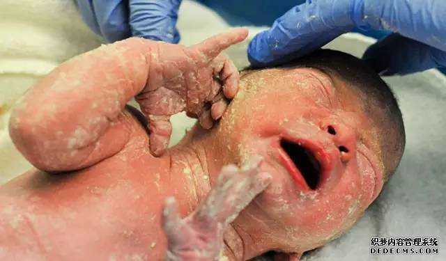国内外的助孕机构有哪些_温州试管婴儿哪家好机构_六安助孕医院提醒：整理出