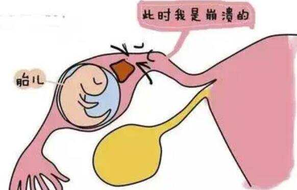 最好代孕公司_晋江助孕哪里可以做第二代试管婴儿？答案在这里